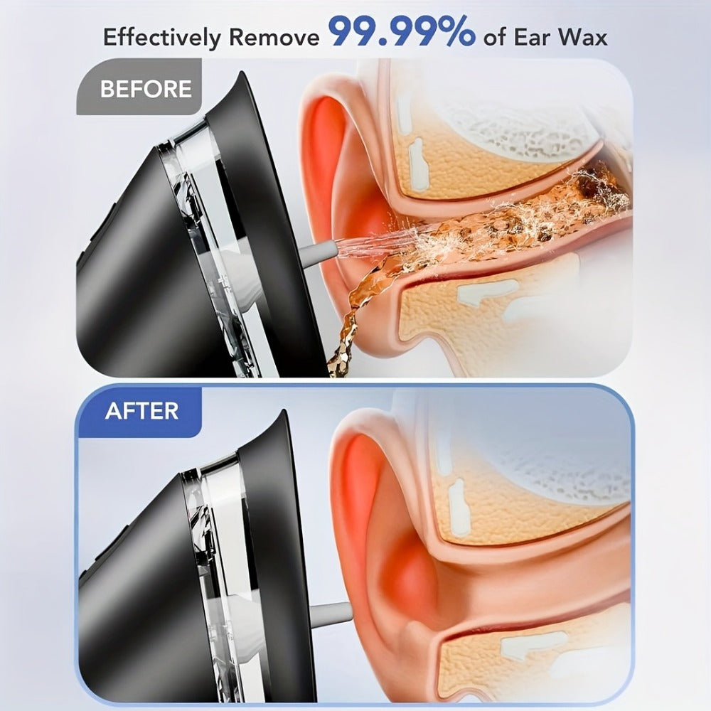 Ear Wax Removal Kit Electric Hydraulic Pro – 3-Speed Water Flushing Ear Cleaner with Temp Sensor, Visual Waste Tank, USB Rechargeable, Nozzle Belt, Medical-Grade Safe Home Ear Care System